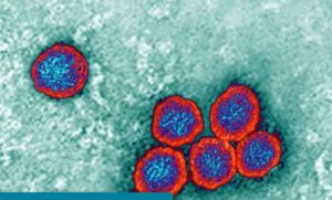 जापानिज इन्सेफलाइटिस