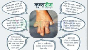  रौतहटमा