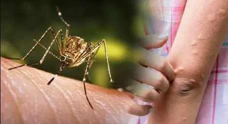 मधेशमा जापानीज इन्सेफ्लाइटिसको जोखिम बढ्यो, १९ संक्रमितमध्ये ६ जनाको मृत्यु